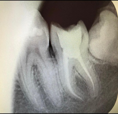 dental bridge cost abu dhabi