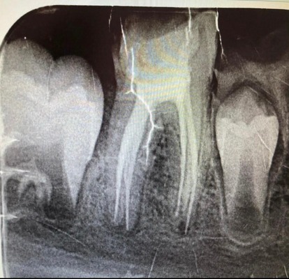 dental implants abu dhabi