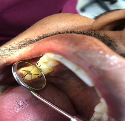 oral surgery in mussafah