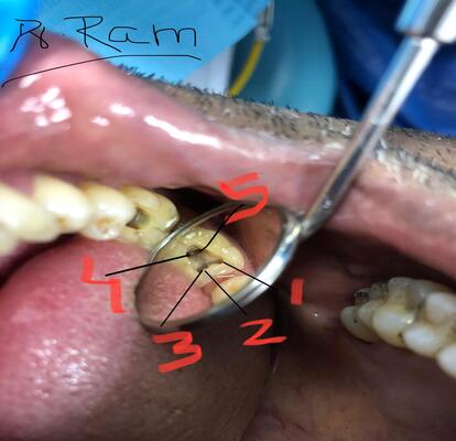 rct dentist in mussafah