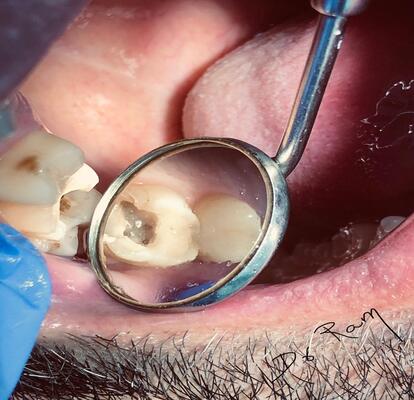 tooth pain treatment in mussafah